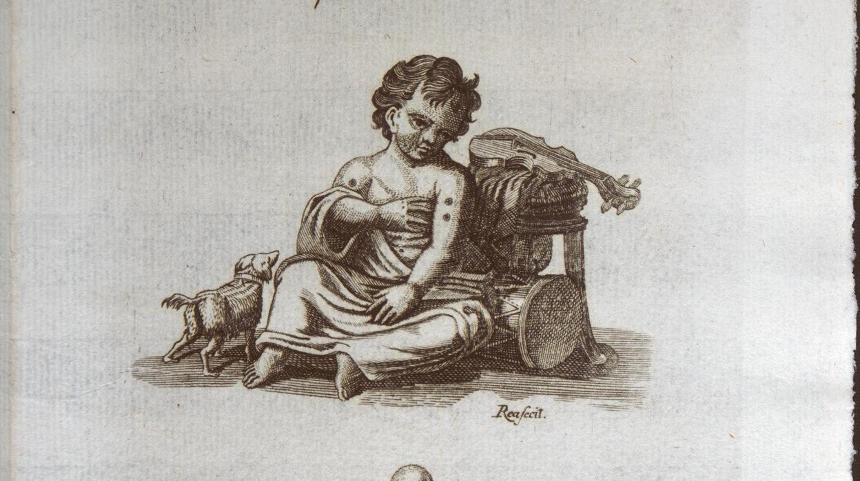 Dibujo de un niño inoculado con la viruela de los que viajó a Filipinas manteniendo en su cuerpo el suero de la vacuna