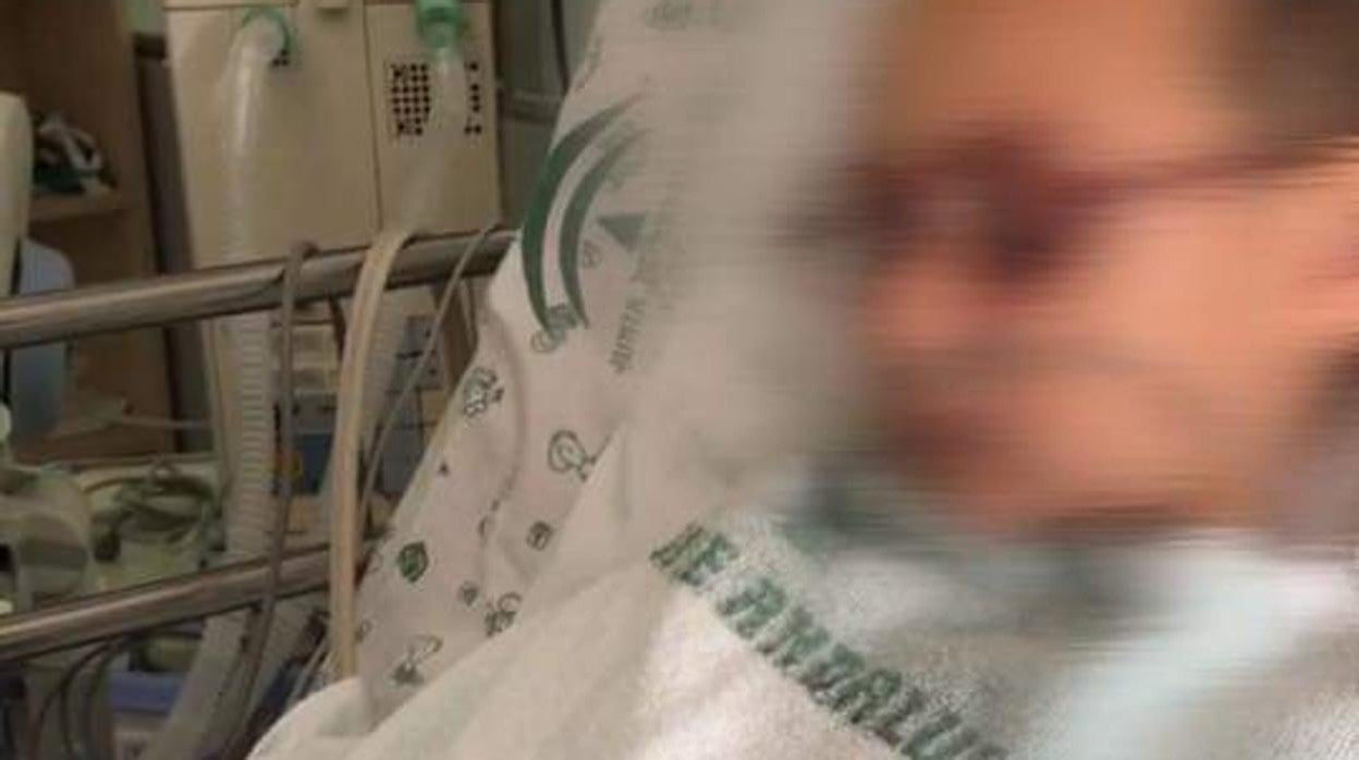 Israel, un menor de cuatro años de Coria del Río, en la UCI el pasado verano