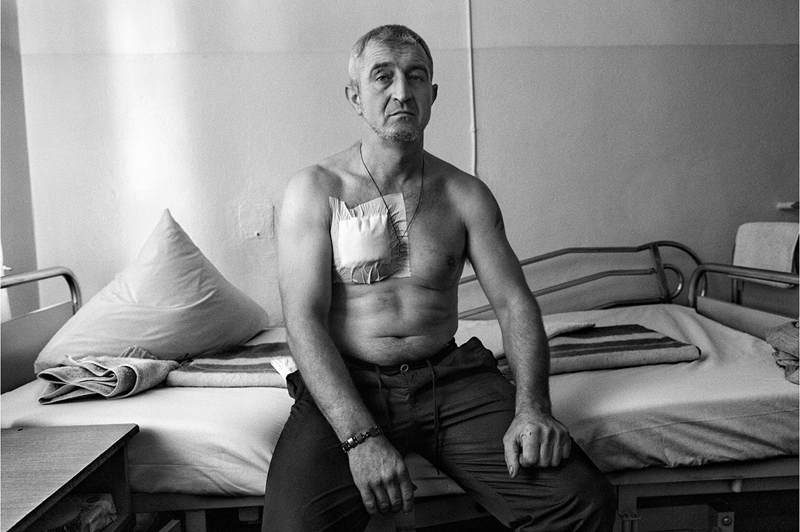 Mykolaiv- Ucrania: : Mykola posa en la cama de un hospital de la ciudad de Mykolaiv mientras que se recupera de una herida de esquirla. Mykola es voluntario militar. Se alistó al ejercito el 1 de Marzo del 2022 tras el inicio de la invasión Rusa. Antereiormente era mecánico de ferrocarriles. Hoy forma parte de una unidad de artillería en el frente de Kherson.