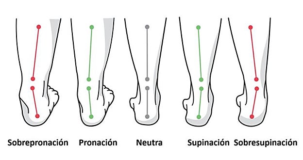Así incide en tu tobillo cada tipo de pisada