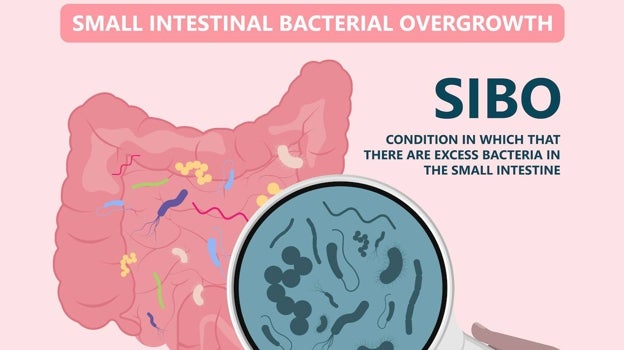 Qué es el SIBO y por qué se habla tanto de él: síntomas, causas y falsos diagnósticos