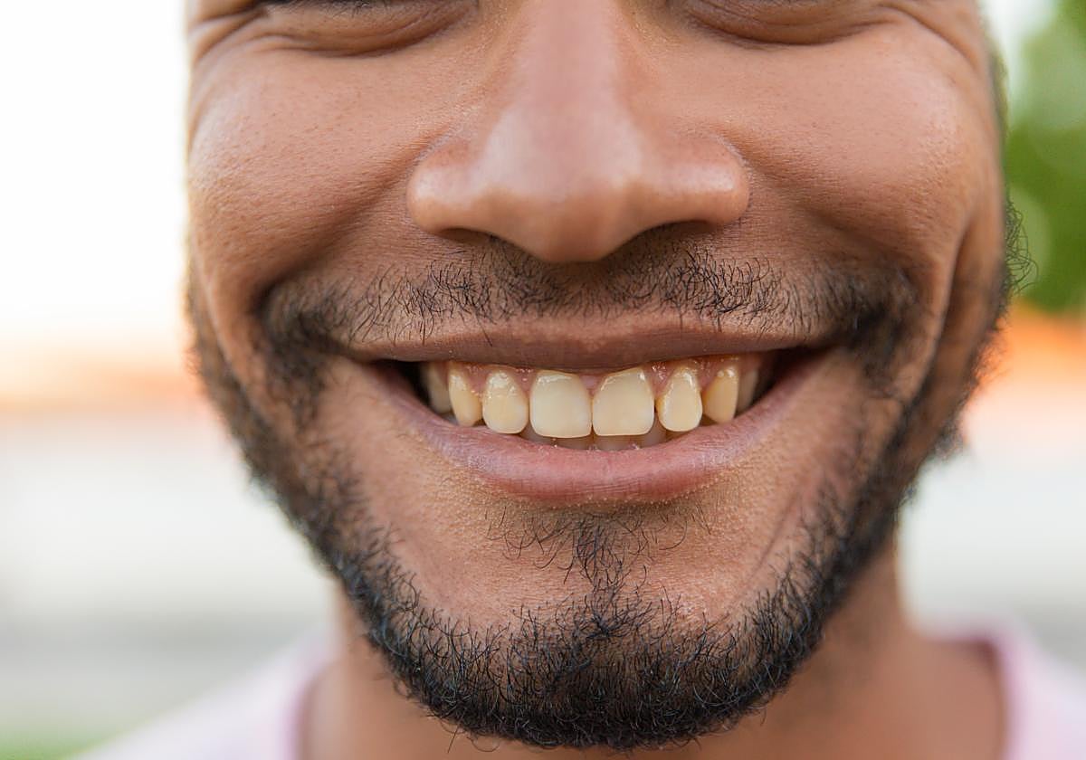 Cómo evitar los dientes amarillos.