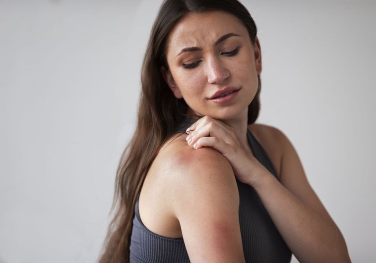 Lo que comes puede ayudar a que te piquen menos los mosquitos