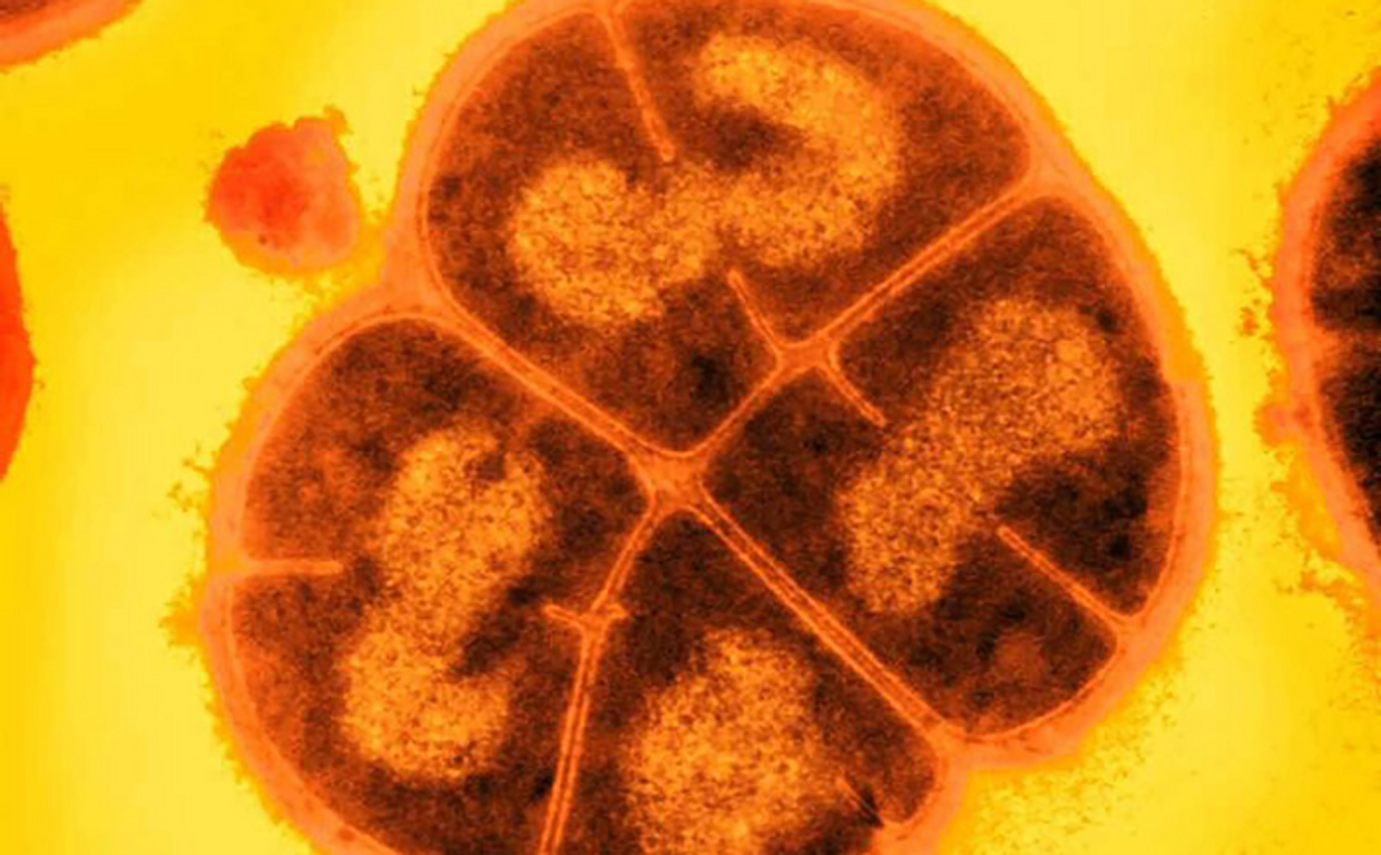 Deinococcus radiodurans, conocida como Conan, la bacteria, es particularmente adecuado para sobrevivir en el duro entorno de Marte. En los experimentos, sobrevivió a cantidades astronómicas de radiación en un ambiente árido y helado.