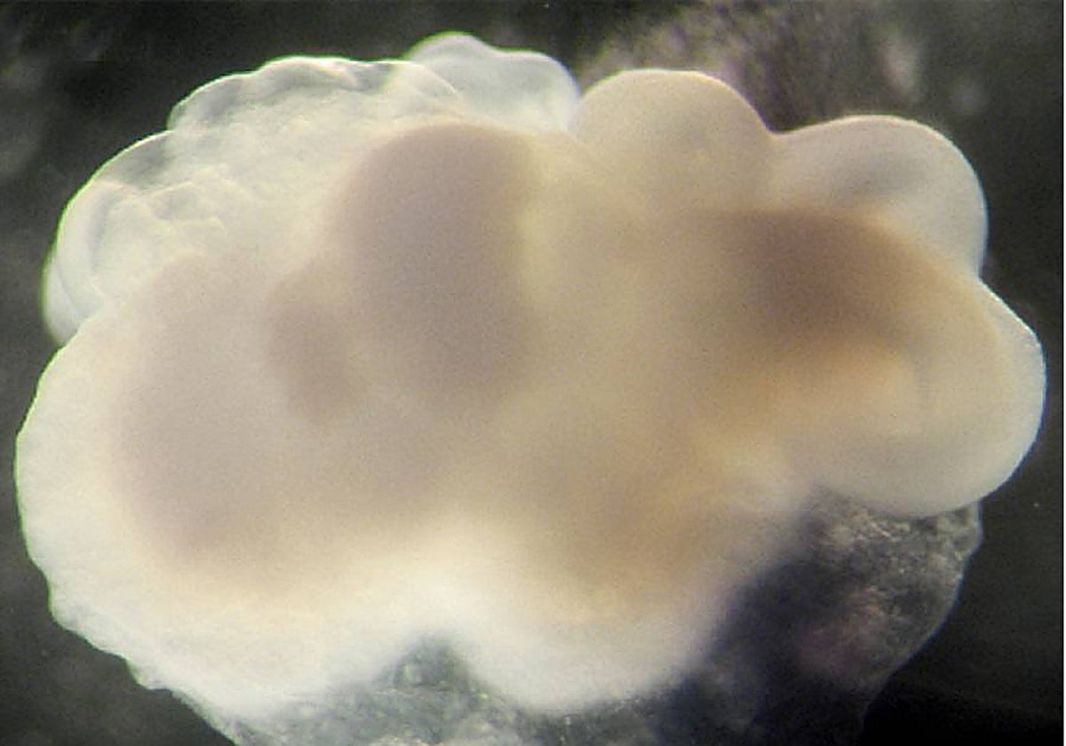 Cada organoide cerebral, como el de la foto, apenas alcanza unos milímetros; sin embargo, son excelentes especímenes de tests y con una materia prima sencilla: células de piel humana