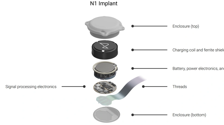 Vista del chip neuronal