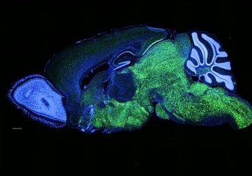 Una única proteína pudo impulsar la aparición del lenguaje humano