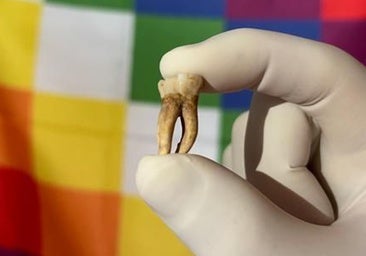 No la llevaron los europeos: la lepra ya estaba en América mil años antes de la llegada de Colón