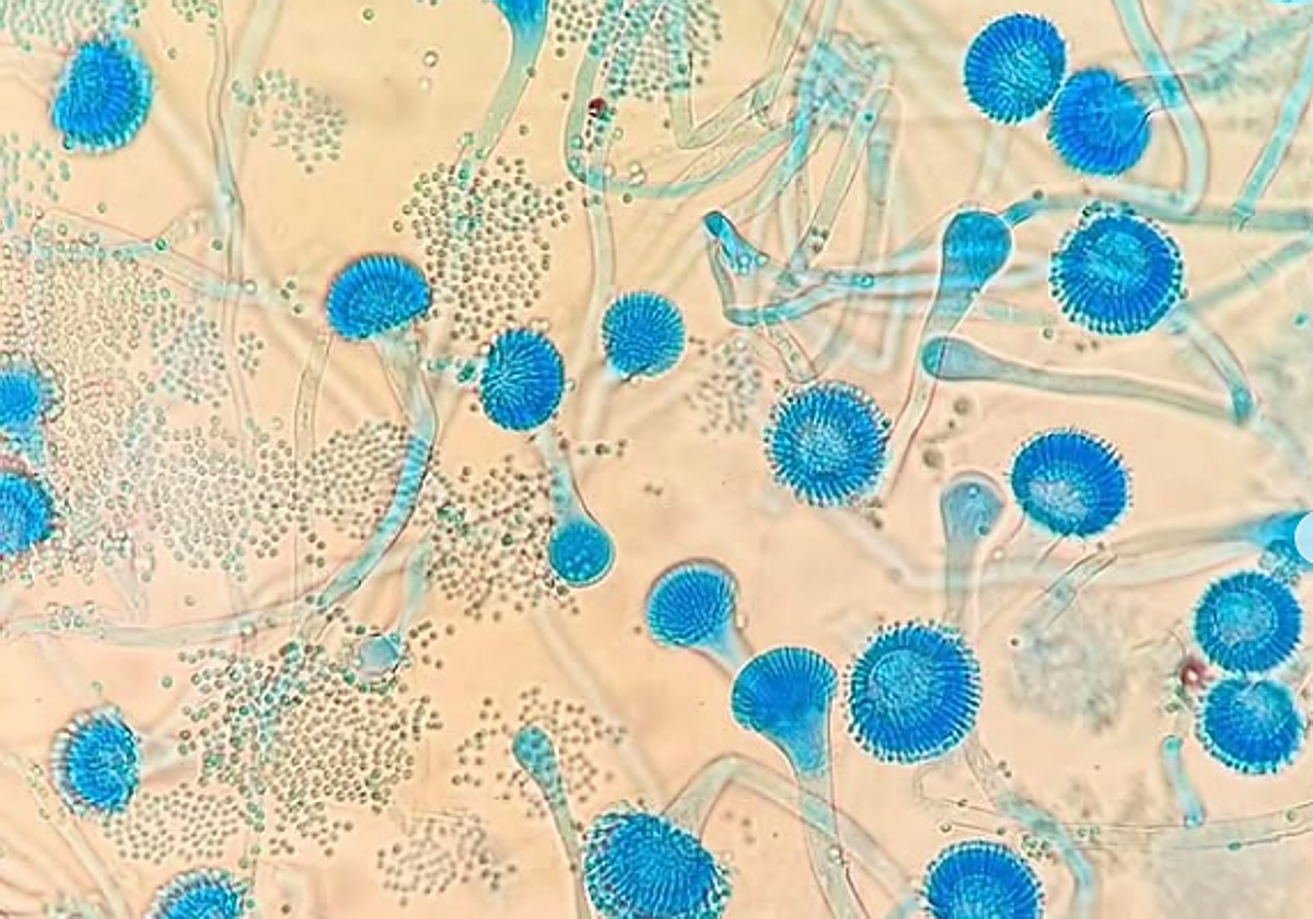 Aspergillus fumigatus es un hongo filamentoso, las colonias crecen rápidamente a 37ºC, son planas, compactas y tienen un aspecto aterciopelado y un color blanquecino que cambia a verde azulado o verde grisáceo.