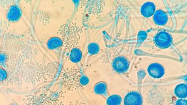 «Vi a un perro joven y sano cuya infección destruyó por completo sus órganos: el hongo literalmente se lo comió por dentro»