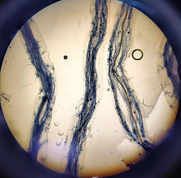 Raíces micorrizadas