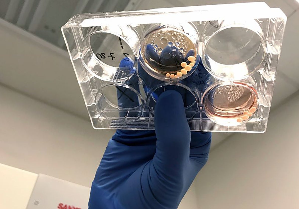 Experimentos de laboratorio con organoides cerebrales que llevan genes NOVA1 modernos o arcaicos examinaron los efectos del plomo en el desarrollo del cerebro