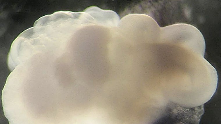 Brain organoid grown from human skin cells