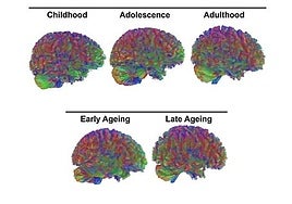 A los 9, 32, 66 y 83 años: las edades en las que el cerebro humano cambia, según la ciencia
