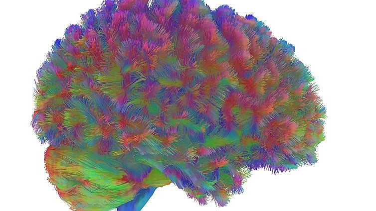 A los 9, 32, 66 y 83 años: las edades en las que el cerebro humano cambia, según la ciencia