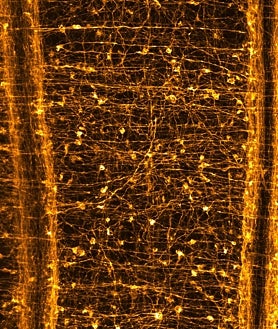 Imagem Secundária 2 – A imagem principal mostra Cassiopeia Andromeda em seu habitat natural; imagem de fluorescência de campo amplo inferior de um Nematostella vectensis adulto mostrando neurônios laranja destacados por uma linha repórter fluorescente transgênica; vista lateral: close da rede nervosa de uma anêmona, que possui uma rede densa e distribuída de neurônios por todo o corpo.
