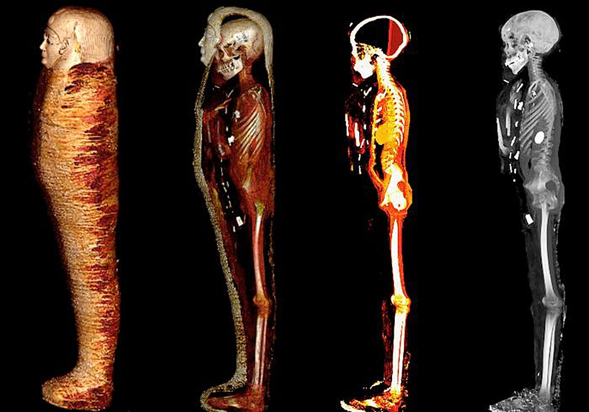 Estudio de la momia del 'Niño de oro'