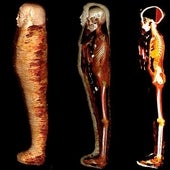 Los secretos de la momia del 'Niño de oro', al descubierto