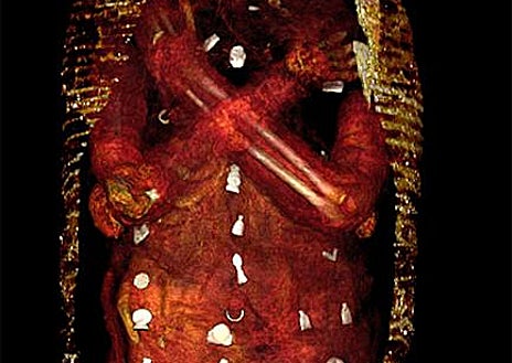 Imagen secundaria 1 - El cuerpo momificado, con la máscara y los adornos vegetales, los amuletos a través de la tomografía computarizada y el sarcófago del 'Niño de oro'