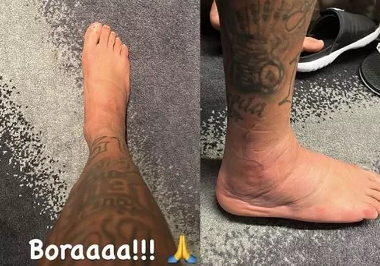 Así está el tobillo de Neymar