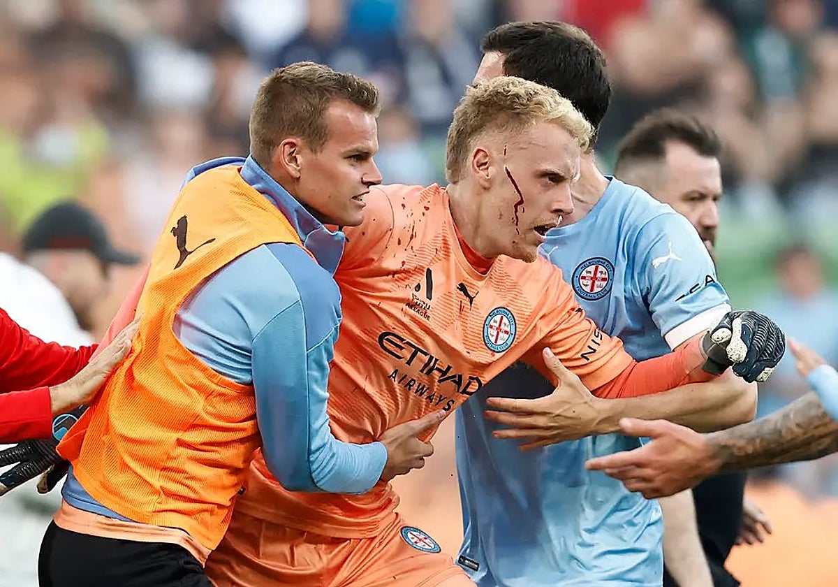 Tom Glover, con heridas en la cara, abandona el campo ayudado por sus compañeros