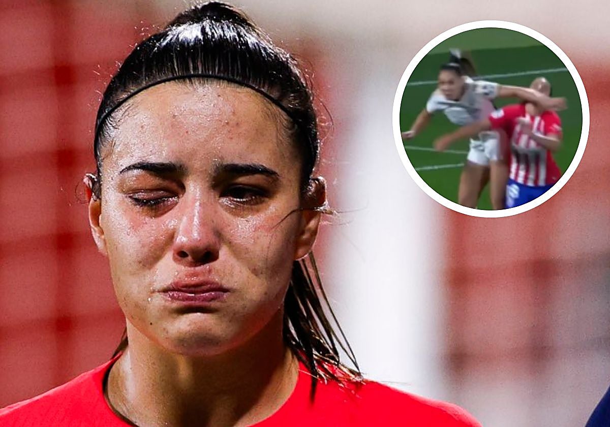 Así quedó el ojo de Sheila tras el codazo