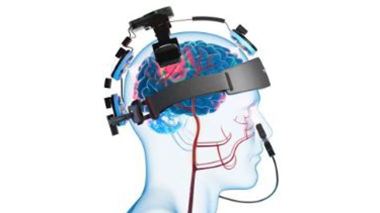 Aparato diseñado para una fotobiomodulación cerebral óptima