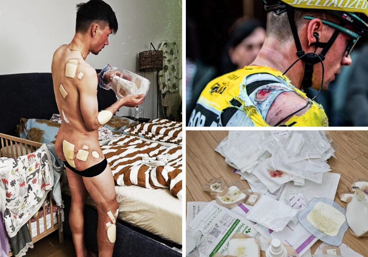 Roglic muestra las heridas sufridas en las caídas durante la Vuelta al País Vasco