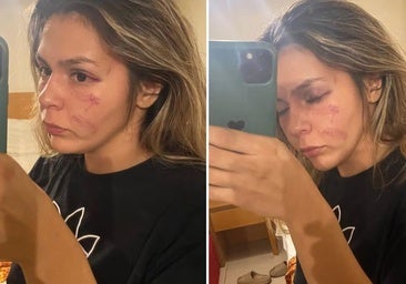 Las impactantes fotos de la paliza que le dio la hiperandrógina argelina a una boxeadora mexicana