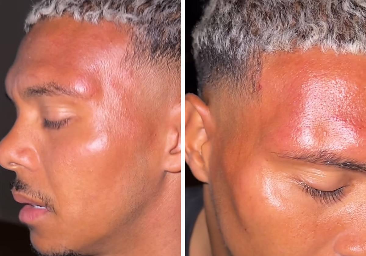 El futbolista Niklas-Wilson Sommer fue agredido la madrugada del domingo