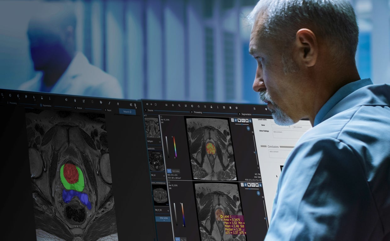 Quibim desarrolla una tecnología pionera con el que desarrolla paneles de biomarcadores de imágenes para mejorar los tratamientos