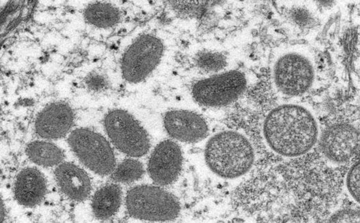 ¿Cuál es el riesgo de transmisión de la viruela del mono en Córdoba?