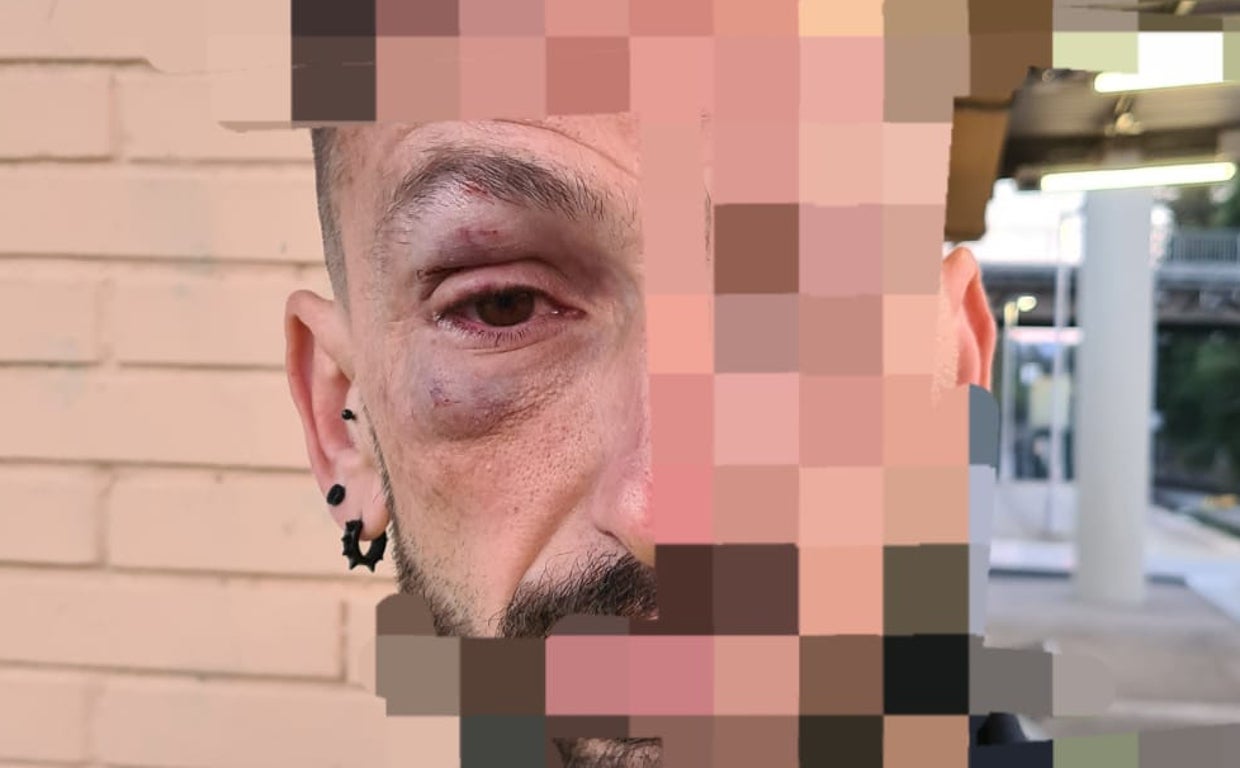 El vigilante de seguridad agredido