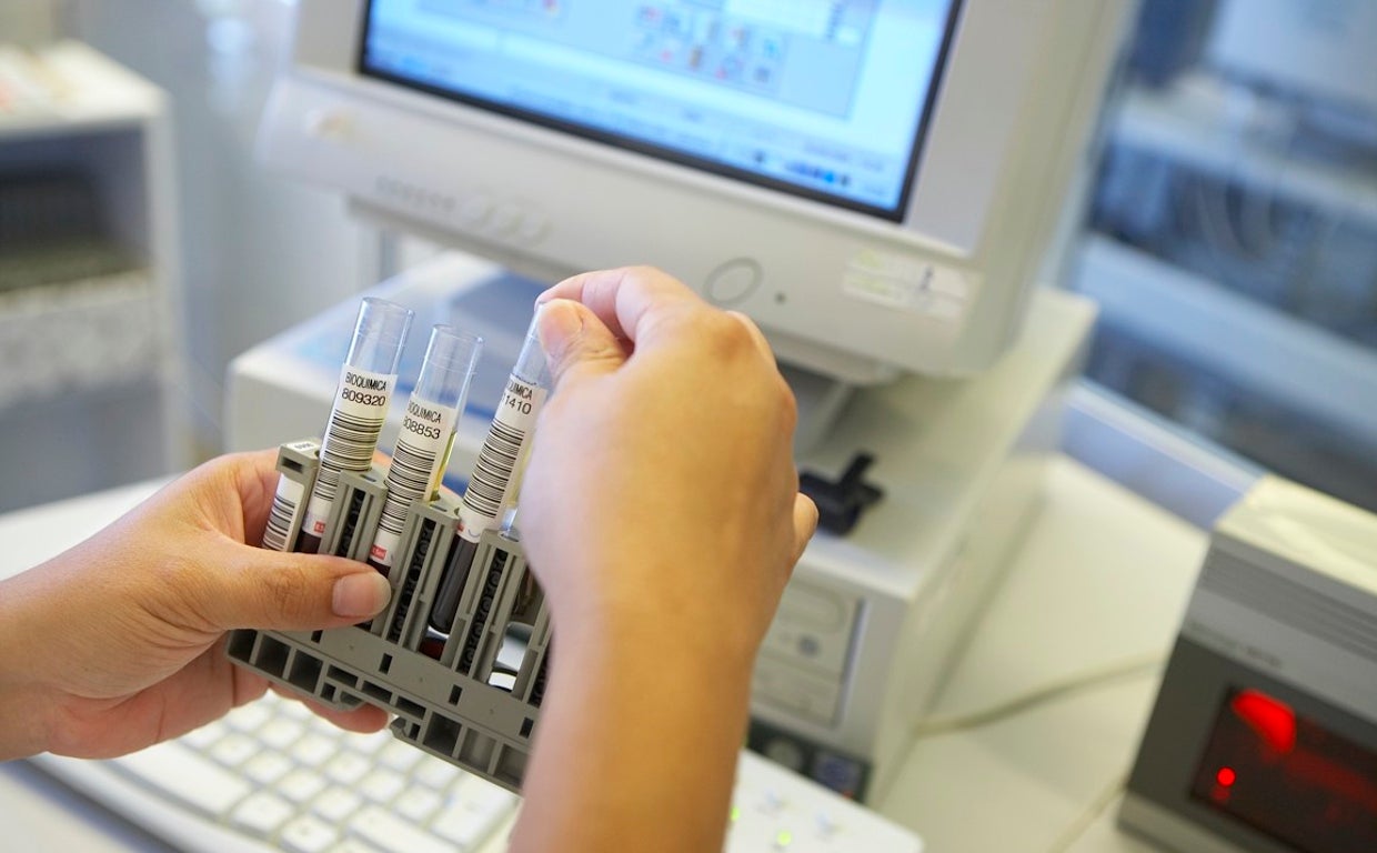 Muestras de sangre en un hospital canario