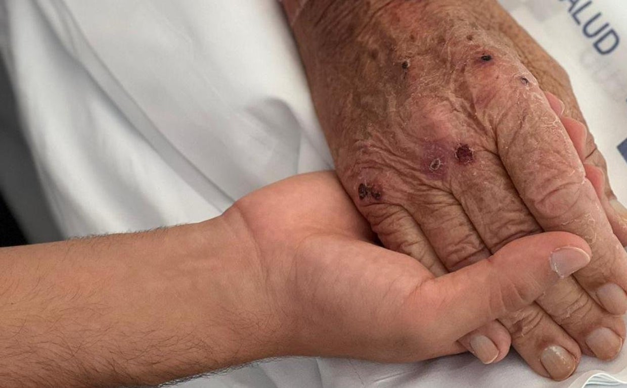 Usuario y acompañante se dan la mano en foto de archivo del SCS