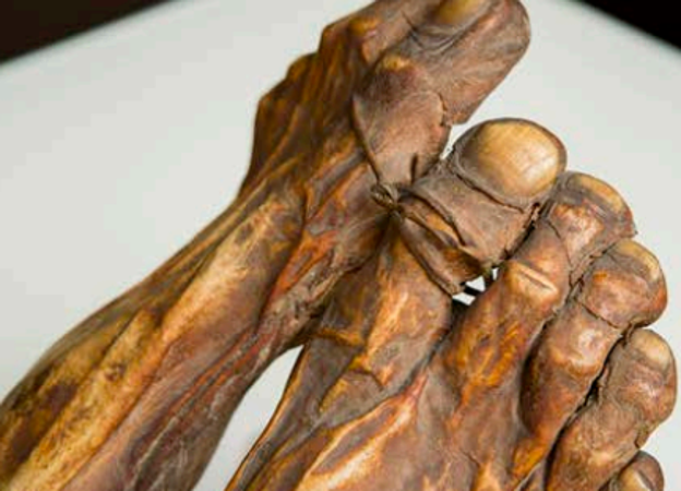 Detalle de la momia guanche de Madrid