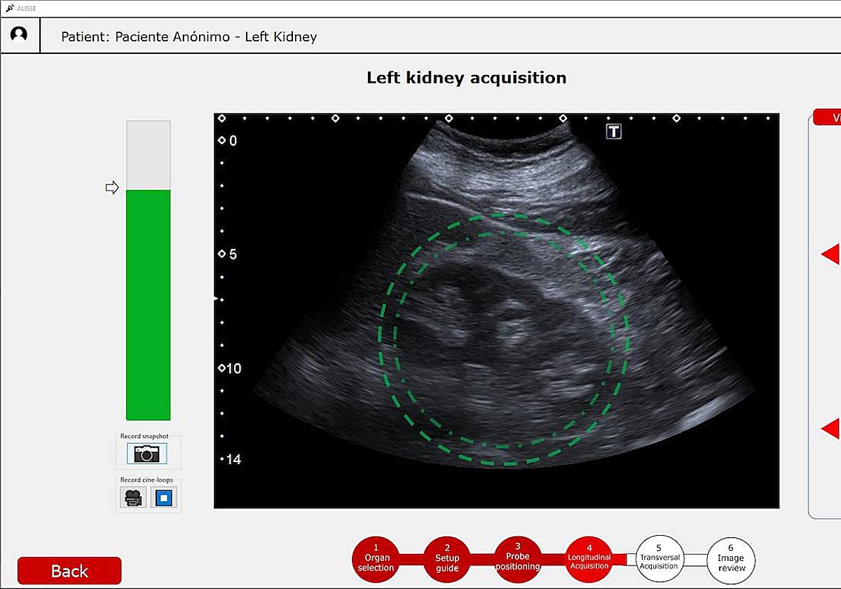 Una imagen por ultrasonido de un riñón, del proyecto que se lleva a cabo desde el Hospital La Paz