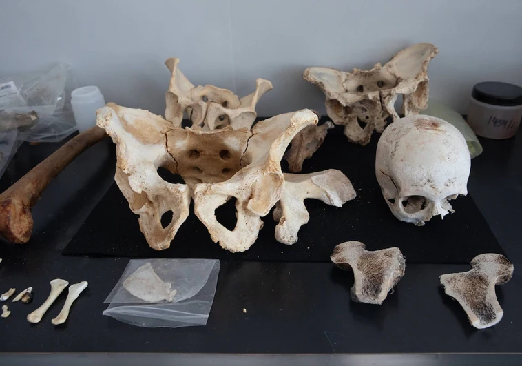 Restos óseos humanos, en el departamento de Antropología Forense