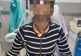 Una mujer llega al hospital encadenada de manos a cuello tras huir de su presunto maltratador