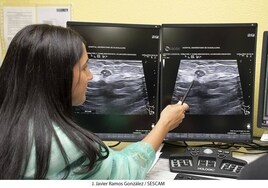 Nueva técnica para abordar los tumores de mama sin operación en el hospital de Guadalajara