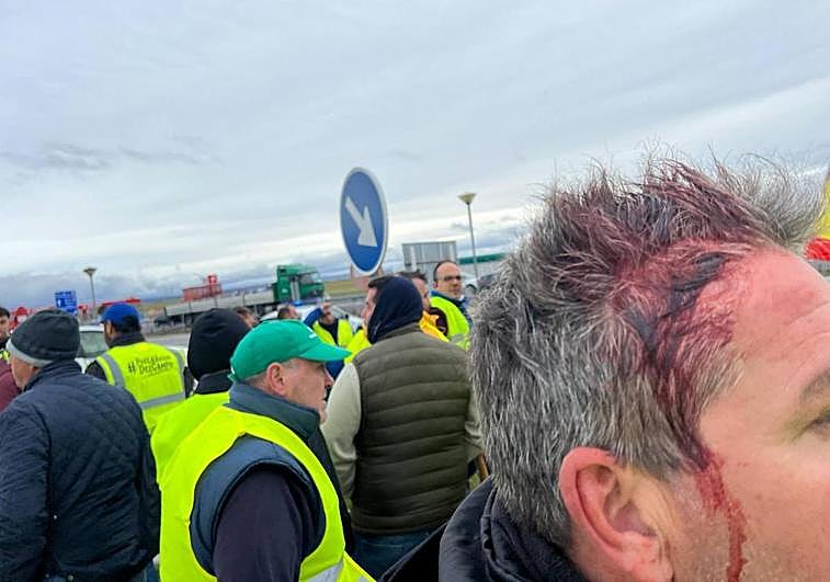 Detalle de uno de los heridos en la carga, en una imagen difundida por la organización agraria Asaja