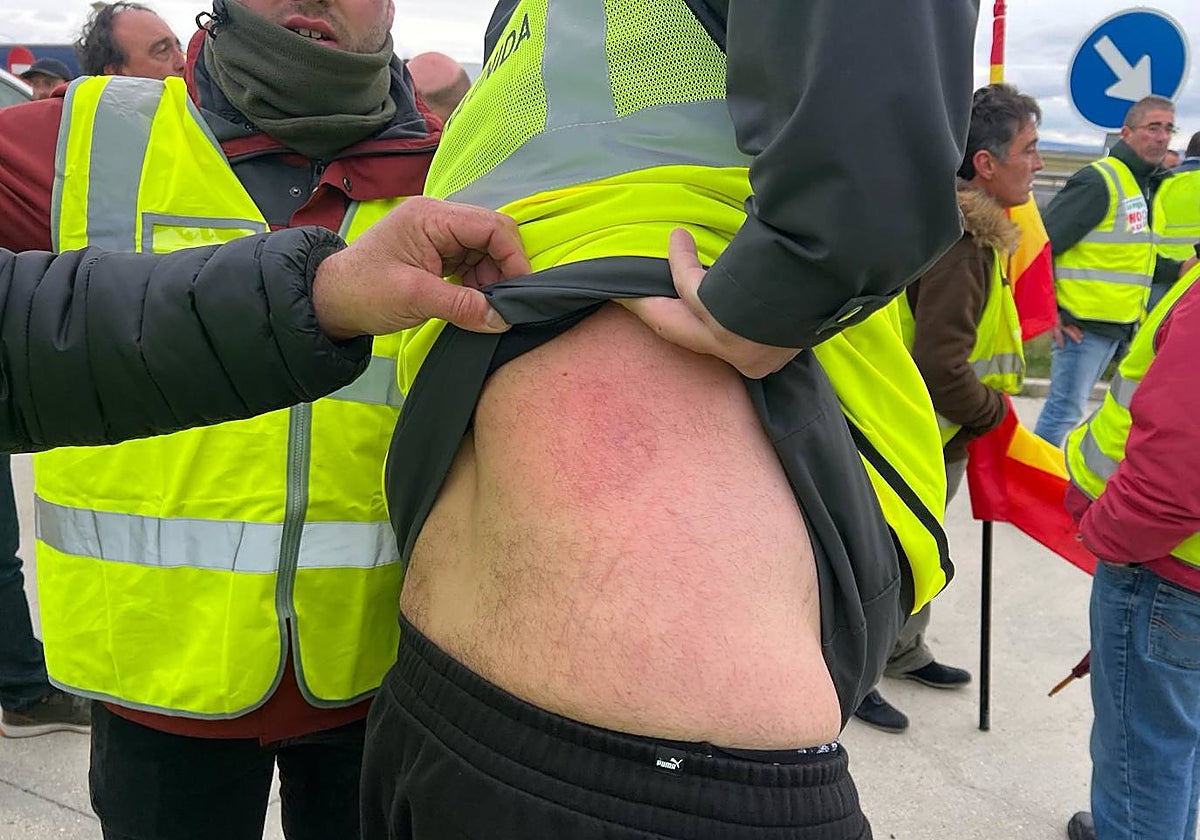 Agricultores presentes en Adanero (Ávila) muestran las supuestas contusiones producidas por las cargas de la Guardia Civil