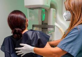 Un ensayo de la Universidad de Córdoba recomienda usar mamografías 3D en los cribados del cáncer de mama