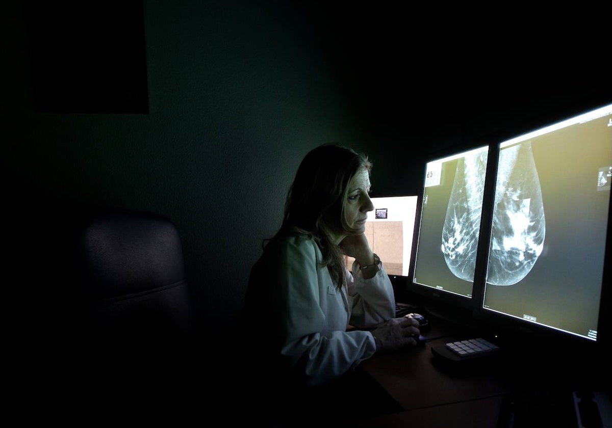 Una doctora observa una mamografía en el hospital Reina Sofía de Córdoba