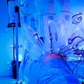 El hospital La Fe de Valencia realiza la primera extracción de riñón de donante vivo mediante cirugía robótica para trasplante renal