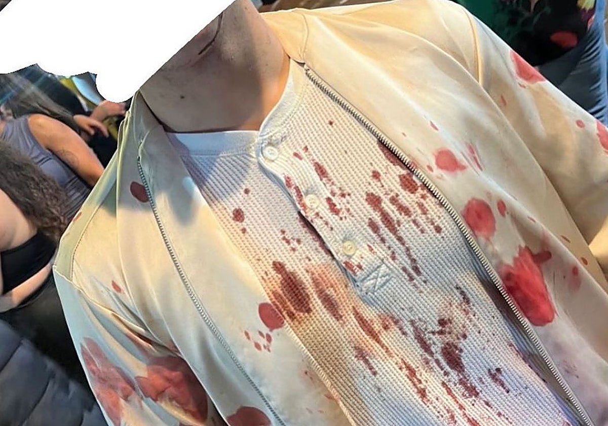 Estado en el que quedó una de las víctimas tras la reyerta