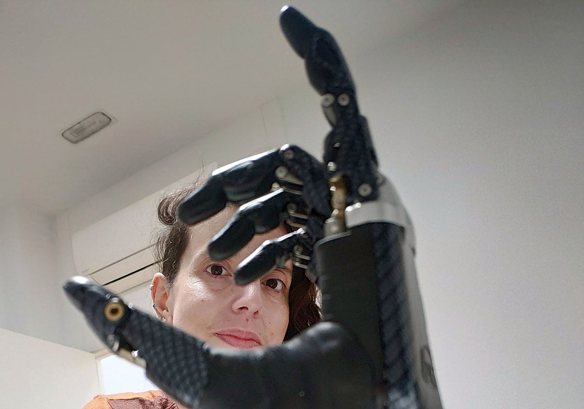 La joven vallisoletana con una de las prótesis