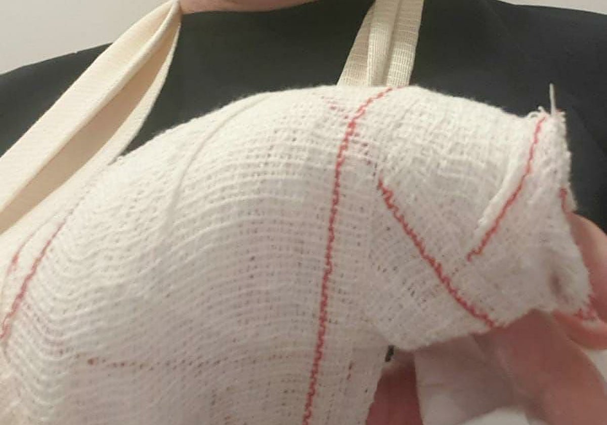 Imagen del funcionario lesionado en el centro penitenciario de Picassent (Valencia)