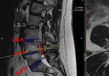 La IA ya mejora la investigación y prevención de la sanidad gallega