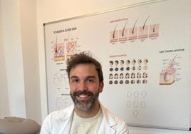 HM IMI Toledo incorpora el servicio de injerto capilar a su Unidad de Medicina Estética